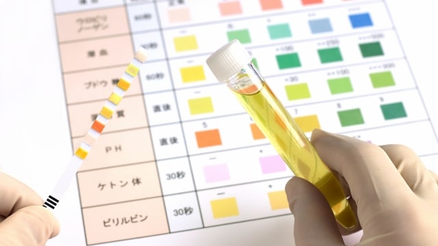 泌尿器のがん